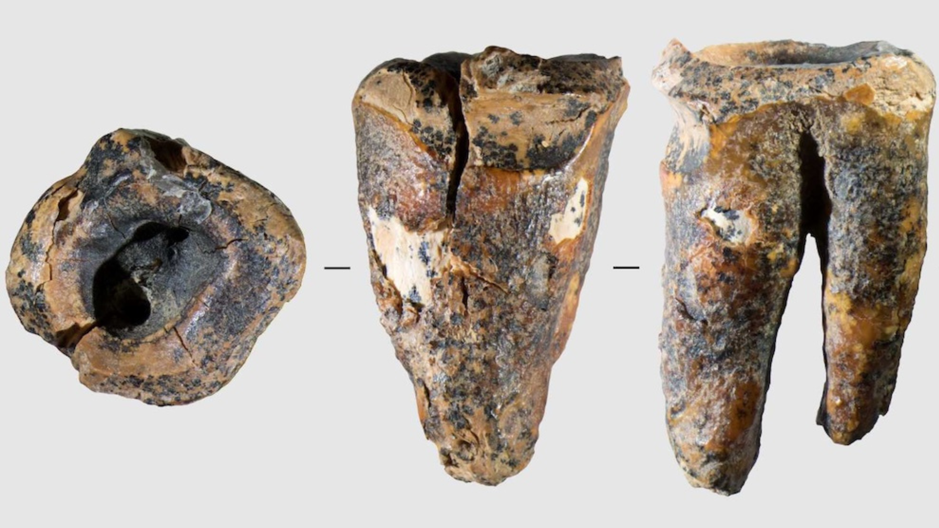 Neandertaller 60 Bin Yıl Önce Diş Tedavisi Yapıyordu: Sibirya’da Bulunan Delinmiş Diş Bilim Dünyasını Sarstı